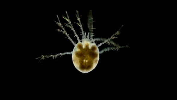 Mite Hydrachnidia Under the Microscope