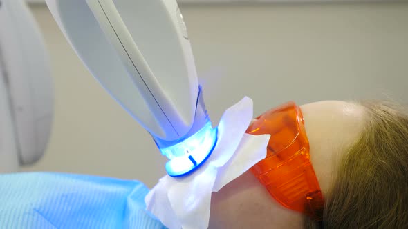 Professional Teeth Whitening or Bleaching Procedure in Modern Dental Clinic