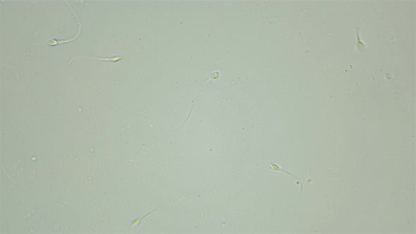 Human sperm under a microscope (spermatozoa)