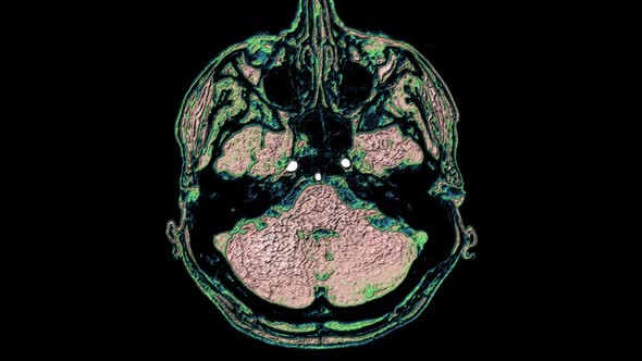 Bulk Multicolored MRI Scans of the Brain and Head To Detect Tumors. Diagnostic Medical Tool