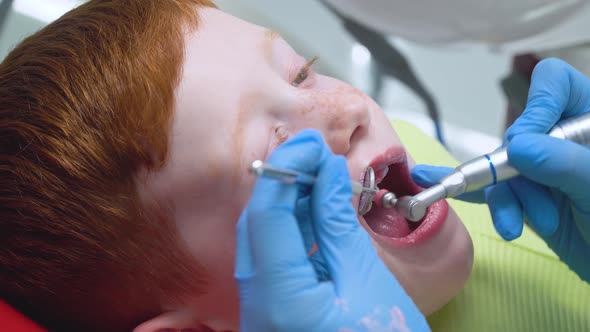 Dentist Examines Baby Teeth