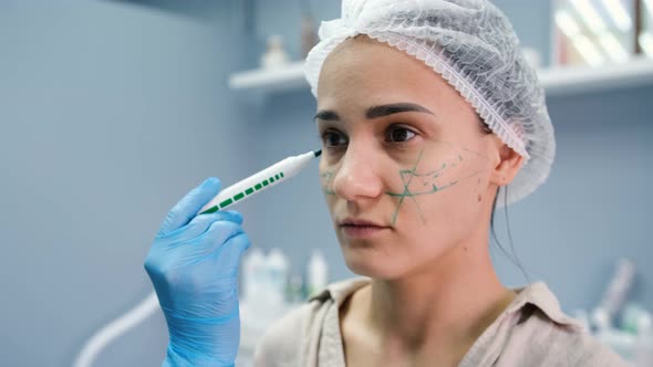 Doctor Cosmetologist Makes Facial Markings to Young Woman Before Cosmetic Injection with Hyaluronic