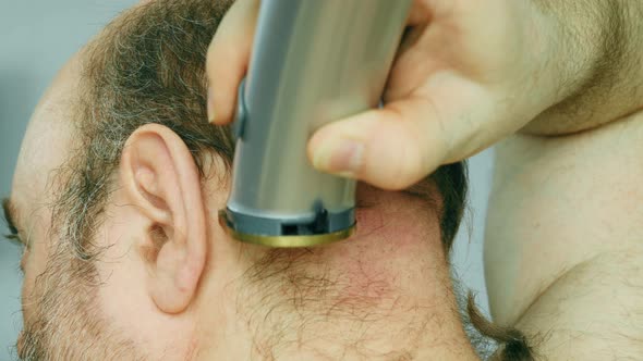 Man shaves his head. An overgrown man with a bald patch clumsily cuts his brown gray hair