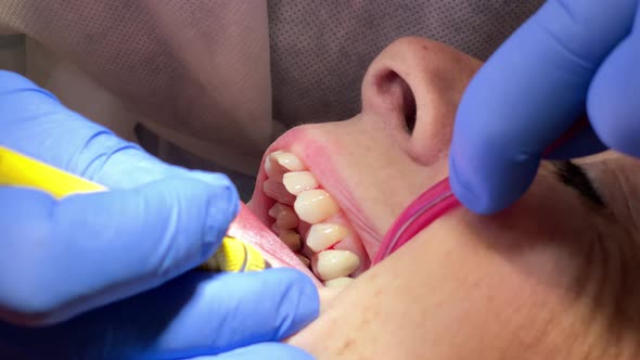 Woman Having Dental Treatment at Dentist's Office