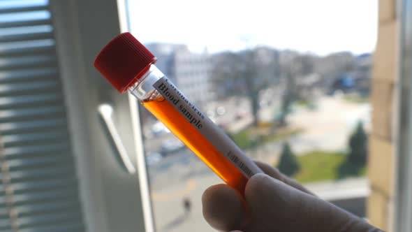 Arm of Medic with Protective Gloves Testing Blood Samples on Hospital