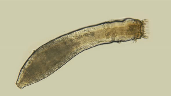 Microscopic Sea Cucumber, Class Holothuroidea, Synaptidae Family, a Relative of Starfish