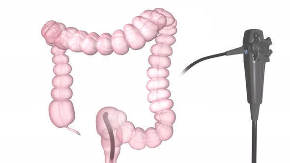 Digestive system- Sigmoid colon, Descending colon