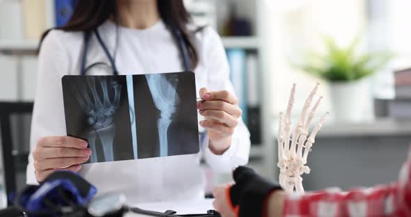 Traumatologist Examines Xray of Patient Hand
