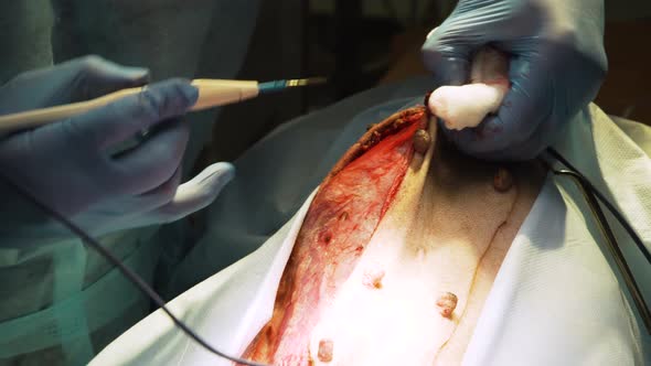 Surgical Operation of a Dog in a Veterinary Clinic