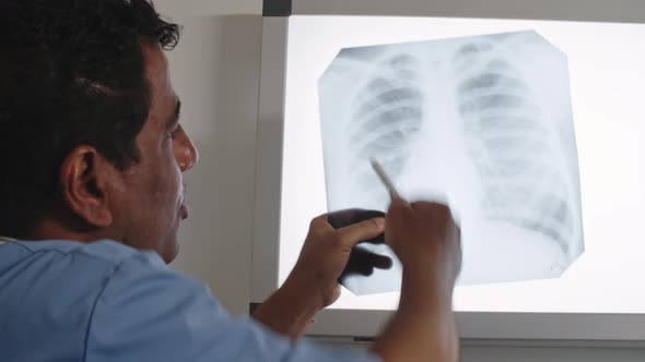 Doctor Explaining X-Ray of Chest