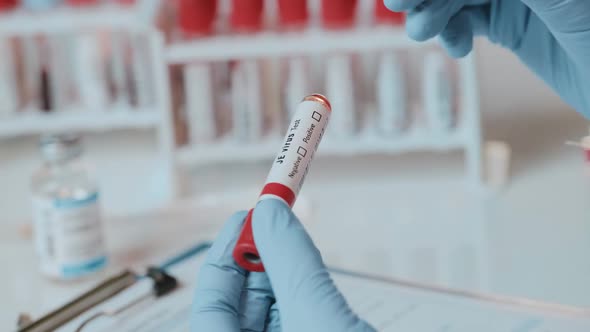 The Doctor Holds Hand Laboratory Positive Blood Test Tube for JE Virus