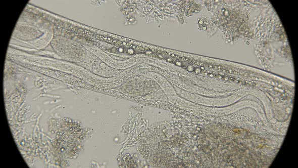 Young Worms Inside Female Turbatrix Aceti