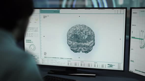 A doctor is examining the patient`s body and finding the tumor in the brain