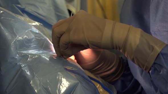 Cataract Surgery 1