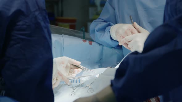 Surgeons working during open heart surgery, close up on hands and instruments.