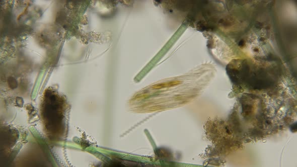 Infusoria Oxytricha Haematoplasma 