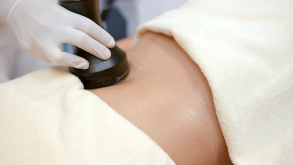 Body Contouring Treatment Rf Machine in Use Woman Receiving Treatment with Rf Machine