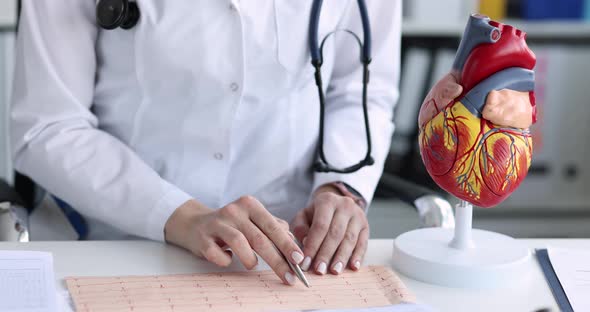 Doctor Cardiologist Examining Electrocardiogram on Background of Artificial Model of Heart Movie