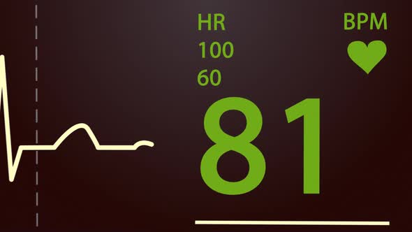 Animation of Intensive Care Unit monitor showing normal values for vital signs.