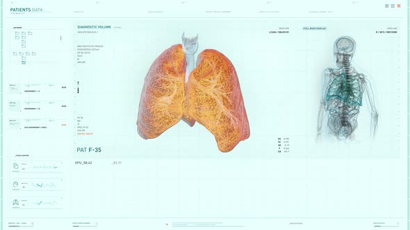 Interface of a modern technology is monitoring the lungs infected with cancer alt