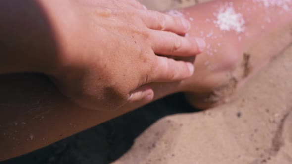 Female Hand Applies and Rubs Sunscreen on the Tanned Red Skin of a Teen Legs