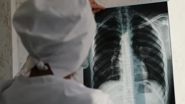 Professional Female Doctor Checking a Patient's Xray