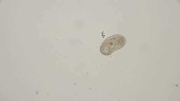 Ciliate Stentor in Free Swimming