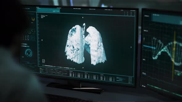 Medical Specialist Analyze Image Of Lungs Built In Biotechnology Software alt