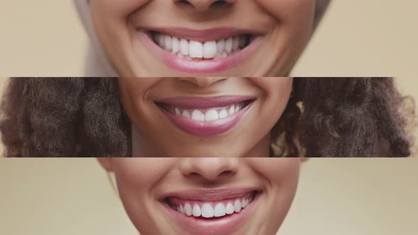 Collage of Unrecognizable Young Diverse Ladies Smiling to Camera Demonstrating Perfect White Teeth