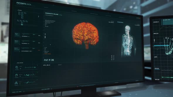 Modern Software For X-ray Of Examination Of A Patient Skull Without Doctor Help alt
