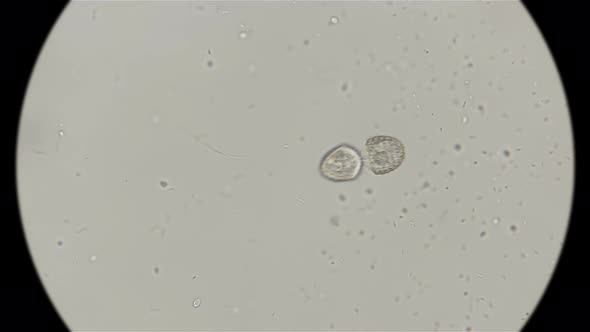 two ciliates Coleps at the stage of division, under the microscope 