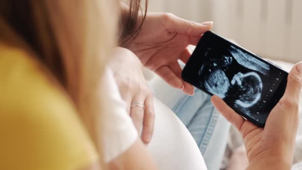 Beautiful Pregnant Woman Holding and Looking Ultrasound Photo Newborn Baby Together with Girlfriend