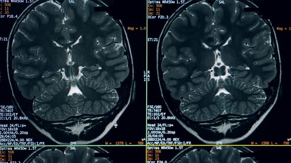 Dynamic CT Images of a Brain on the Computer Screen