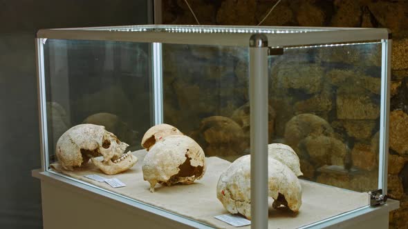 Human Skull in a Showcase