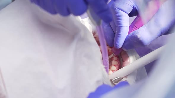 Dentist Conducts Dental Hygiene To the Patient