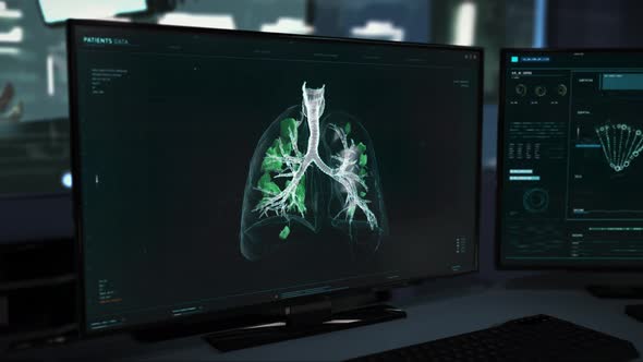 The Patient`s Lungs are being Analyzed for Covid Traces in the modern Laboratory