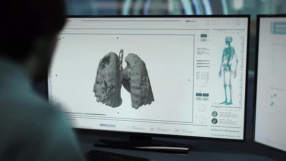 Medical Scan Examination Detects Covid-19 Respiratory Pneumonia Lungs Disease