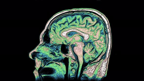 Bulk Multicolored MRI Scans of the Brain and Head To Detect Tumors. Diagnostic Medical Tool