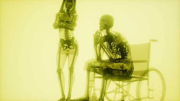 Man in Wheelchair with Visible Bones alt