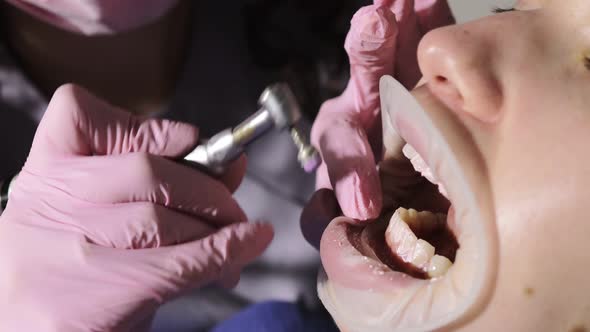 Dentist making professional teeth cleaning female young patient at the dental office. Close-up plan.