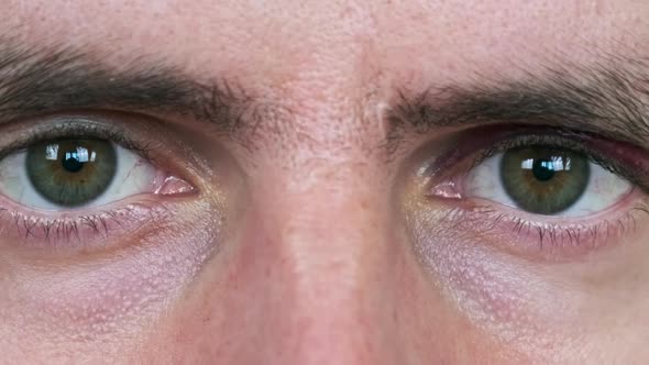 Bruise Over the Eye of a Man Closeup