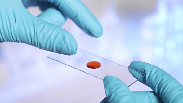 A Close-up of a Red Blood Drop Dropping From a Pipette Onto Laboratory Slide Glasses for Testing.