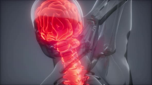 Backache in Back Bones alt