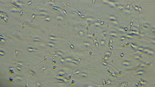 Human Sperm Under a Microscope (Spermatozoa), Consists of Sperm and Seminal Fluid