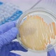 Scientist examines a petri dish with bacteria - VideoHive Item for Sale