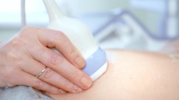 In the Hospital, Close-up Shot of the Doctor Does Ultrasound / Sonogram Procedure To a Pregnant