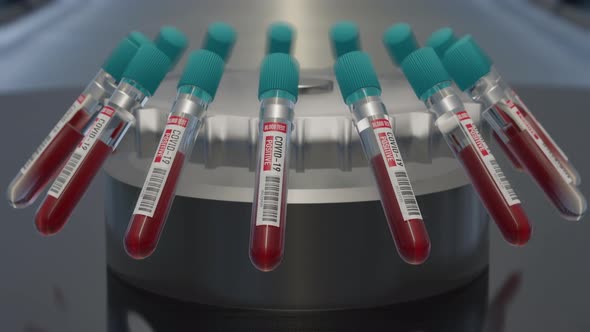 Coronavirus blood test positive Analyzing blood sample in test tubes for coronavirus test.