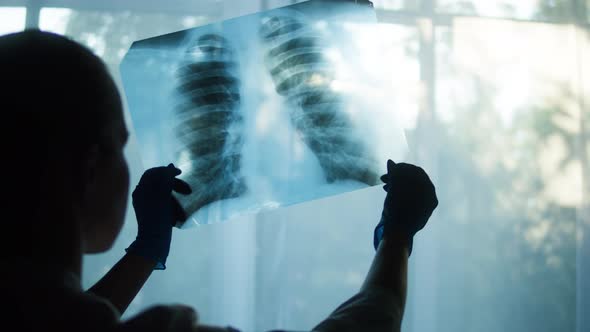 Studying Xray Image of Human Chest on Window Background Doctor Checking Fluorography of Patient