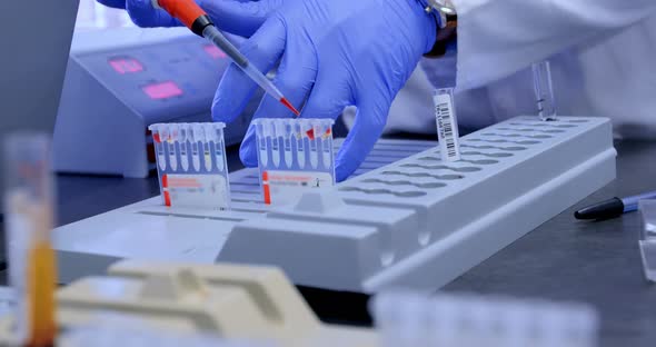 Doctor testing blood sample in blood bank 4k