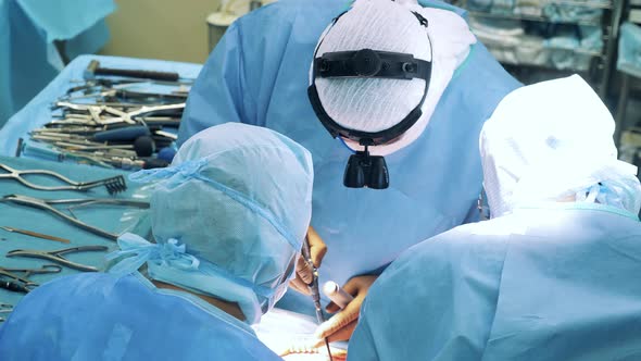 Team of Surgeons are Performing an Operation